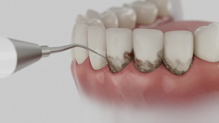 Reliable Teeth Cleaning And Checkup contractor in Barton County County, MO by Dentist Open Now